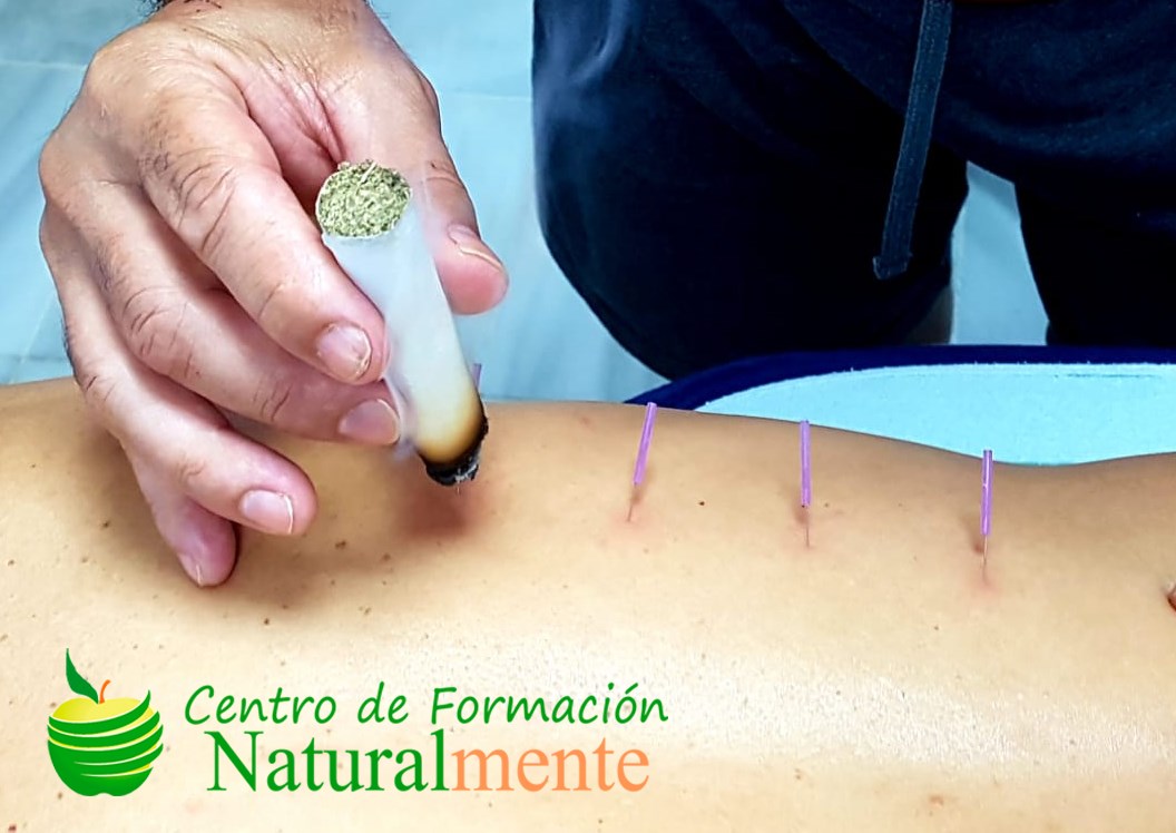CURSO DE ACUPUNTURA PROFUNDA MIOFASCIAL