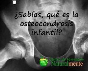 Osteocondrosis-en-la-infancia-y-adolescencia